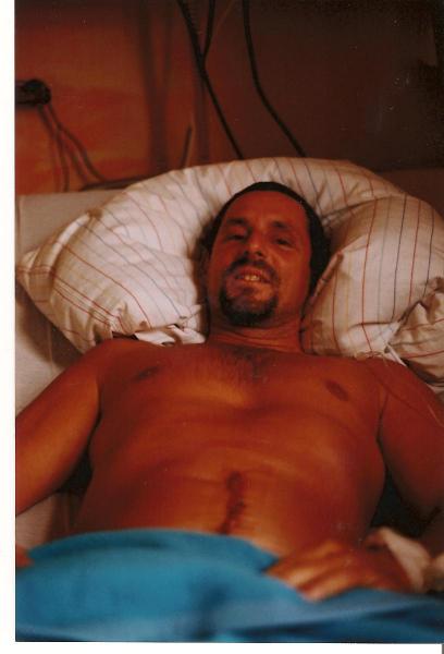 Day or so after surgery